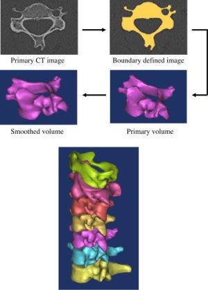 Generating a finite element model of the cervical spine: Estimating muscle forces and internal loads