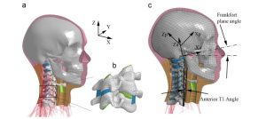 A female head–neck model for rear impact simulations